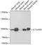 EMSY Transcriptional Repressor, BRCA2 Interacting antibody, 22-024, ProSci, Western Blot image 