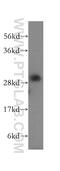 CR antibody, 15279-1-AP, Proteintech Group, Western Blot image 