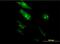 TGFB Induced Factor Homeobox 2 antibody, H00060436-M06, Novus Biologicals, Immunofluorescence image 