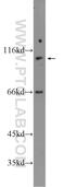 Family With Sequence Similarity 160 Member B1 antibody, 25388-1-AP, Proteintech Group, Western Blot image 