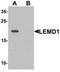 LEM Domain Containing 1 antibody, orb75694, Biorbyt, Western Blot image 