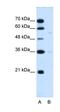 Major Facilitator Superfamily Domain Containing 12 antibody, orb325197, Biorbyt, Western Blot image 