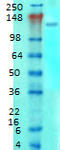 Glutamate Metabotropic Receptor 5 antibody, TA326541, Origene, Western Blot image 