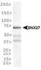 Sorting nexin-27 antibody, NBP1-45282, Novus Biologicals, Western Blot image 