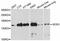 Nitric Oxide Synthase 3 antibody, A1548, ABclonal Technology, Western Blot image 