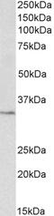 Glutathione Peroxidase 1 antibody, 43-087, ProSci, Western Blot image 