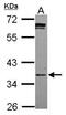 Phosphopantothenoylcysteine Synthetase antibody, PA5-31620, Invitrogen Antibodies, Western Blot image 