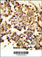 Hsp110 antibody, 61-559, ProSci, Immunohistochemistry paraffin image 
