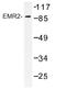 Adhesion G Protein-Coupled Receptor E2 antibody, AP01214PU-N, Origene, Western Blot image 