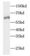 2-Hydroxyacyl-CoA Lyase 1 antibody, FNab03746, FineTest, Western Blot image 
