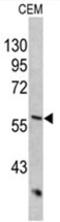Keratin 10 antibody, AP17525PU-N, Origene, Western Blot image 