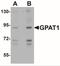 Glycerol-3-Phosphate Acyltransferase, Mitochondrial antibody, NBP1-76907, Novus Biologicals, Western Blot image 