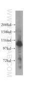 Retinoic Acid Induced 14 antibody, 17507-1-AP, Proteintech Group, Western Blot image 