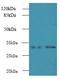 NmrA Like Redox Sensor 1 antibody, LS-C379477, Lifespan Biosciences, Western Blot image 