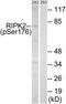 Receptor-interacting serine/threonine-protein kinase 2 antibody, TA312995, Origene, Western Blot image 