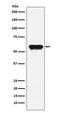 Angiotensinogen antibody, M02103-3, Boster Biological Technology, Western Blot image 
