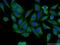 Phosphatidylinositol 3-kinase regulatory subunit alpha antibody, 60225-1-Ig, Proteintech Group, Immunofluorescence image 