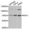 Replication protein A 70 kDa DNA-binding subunit antibody, LS-C331186, Lifespan Biosciences, Western Blot image 
