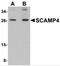 Secretory Carrier Membrane Protein 4 antibody, 5289, ProSci Inc, Western Blot image 