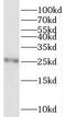 Testis Expressed 38 antibody, FNab08613, FineTest, Western Blot image 