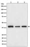 Cathepsin L antibody, M01589, Boster Biological Technology, Western Blot image 