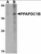 Phospholipid Phosphatase 5 antibody, orb89851, Biorbyt, Western Blot image 