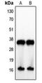 IL-4 antibody, orb214098, Biorbyt, Western Blot image 