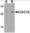 C-Type Lectin Domain Containing 7A antibody, orb137321, Biorbyt, Western Blot image 