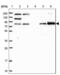 Ankyrin Repeat Domain 13A antibody, NBP2-38505, Novus Biologicals, Western Blot image 