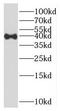 Homeobox D13 antibody, FNab03986, FineTest, Western Blot image 