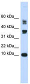 Fatty Acid Binding Protein 3 antibody, TA342387, Origene, Western Blot image 