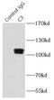 Complement C3 antibody, FNab01102, FineTest, Immunoprecipitation image 