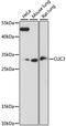 Chloride Intracellular Channel 3 antibody, A15347, ABclonal Technology, Western Blot image 