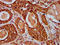 WAS/WASL Interacting Protein Family Member 2 antibody, LS-C681708, Lifespan Biosciences, Immunohistochemistry paraffin image 