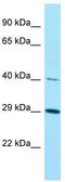 KTI12 Chromatin Associated Homolog antibody, TA337918, Origene, Western Blot image 