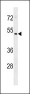 HEPACAM Family Member 2 antibody, LS-C159821, Lifespan Biosciences, Western Blot image 
