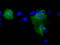 26S protease regulatory subunit 6A antibody, TA500923, Origene, Immunofluorescence image 
