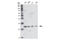 Von Hippel-Lindau Tumor Suppressor antibody, 2738S, Cell Signaling Technology, Western Blot image 