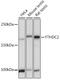 YTH Domain Containing 2 antibody, GTX66320, GeneTex, Western Blot image 