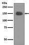Neurotrophic Receptor Tyrosine Kinase 1 antibody, M00706-1, Boster Biological Technology, Western Blot image 