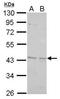 BRISC And BRCA1 A Complex Member 2 antibody, TA307887, Origene, Western Blot image 
