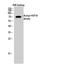 Heat shock 70 kDa protein 1A/1B antibody, STJ97228, St John