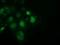 Sepiapterin Reductase antibody, GTX83572, GeneTex, Immunocytochemistry image 