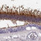 GRK1 antibody, HPA059376, Atlas Antibodies, Immunohistochemistry frozen image 