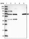 Family With Sequence Similarity 13 Member A antibody, PA5-58250, Invitrogen Antibodies, Western Blot image 