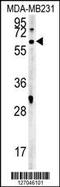 Leucine Rich Repeat Containing 15 antibody, LS-C165855, Lifespan Biosciences, Western Blot image 