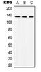ABL Proto-Oncogene 1, Non-Receptor Tyrosine Kinase antibody, LS-C353897, Lifespan Biosciences, Western Blot image 