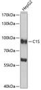 Complement C1s antibody, GTX64606, GeneTex, Western Blot image 
