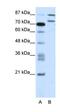 Zinc Finger Protein 709 antibody, orb324632, Biorbyt, Western Blot image 