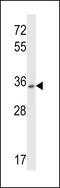 P2Y Receptor Family Member 10 antibody, LS-C163319, Lifespan Biosciences, Western Blot image 